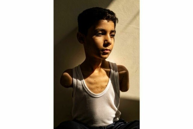 Bildet av dobbeltamputerte Mahmoud Ajjour, som mistet begge armene etter et israelsk angrep på Gazastripen, er kåret til årets pressebilde.