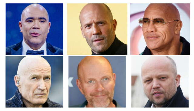 Er du skallet, i likhet med komiker Johan Golden, skuespiller Jason Statham, skuespiller Dwayne «The Rock» Johnson, tidligere landslagskeeper Erik Thorstvedt, komiker Bård Tufte Johansen og Sp-leder Trygve Slagsvold Vedum? Da har du kanskje teken på damene. En ny undersøkelse viser hva kvinner synes er mest attraktivt ved menn.