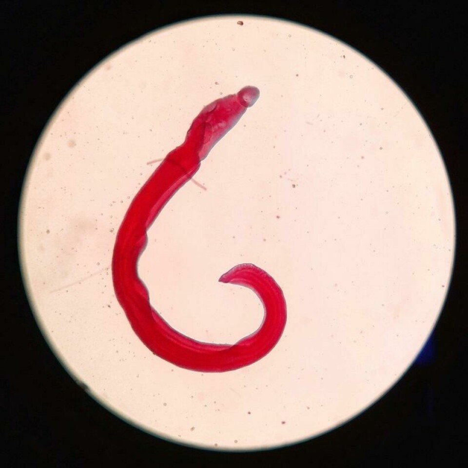 Vær på vakt for denne luringen – schistosomiasis. Parasitten kan trenge seg gjennom huden på mennesker, og føre til alvorlig sykdom og komplikasjoner. Vær på vakt for denne luringen – schistosomiasis. Parasitten kan trenge seg gjennom huden på mennesker, og føre til alvorlig sykdom og komplikasjoner. Foto: Zulfa Zahra Salsabila / Shutterstock / NTB