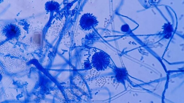 Kontakt og inntak av muggsoppen kan forårsake astma, høysnue og mer livstruende lungeinfeksjoner. Yayah_Ai / Shutterstock / NTB