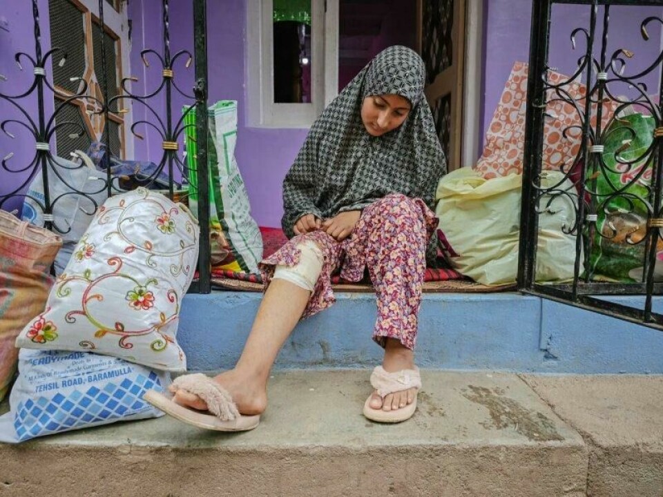 Ni år gamle Bisma Farooq viser frem skaden hun fikk under granatangrepet i Uri forrige uke. Ni år gamle Bisma Farooq viser frem skaden hun fikk under granatangrepet i Uri forrige uke. Foto: Showkat Nanda
