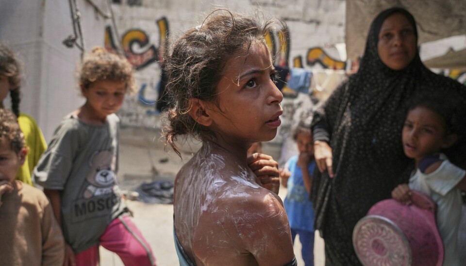 Bryter Israels krigføring i Gaza med forutsetningene i EUs handelsavtale med Israel? Nå vurderes saken på høyeste EU-nivå. Her får en liten jente hjelp etter å ha blitt forbrent i en matkø.