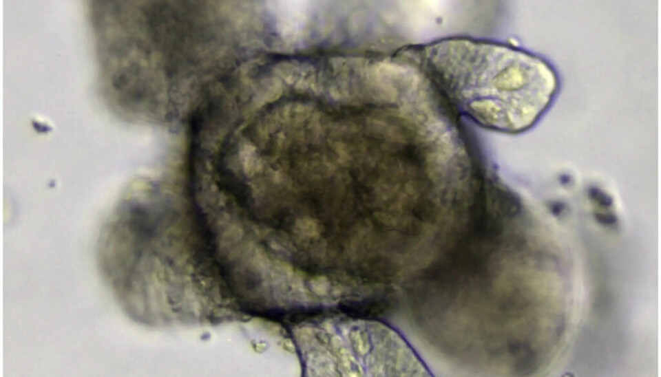 Illustrasjonsbilde av en tarmorganoide. (CC BY 4.0 https://www.forskning.no/biologi-naturvitenskap/gjennombrudd-mini-hjerter-og-lunger-kan-na-gro-sine-egne-blodarer/2534188 )