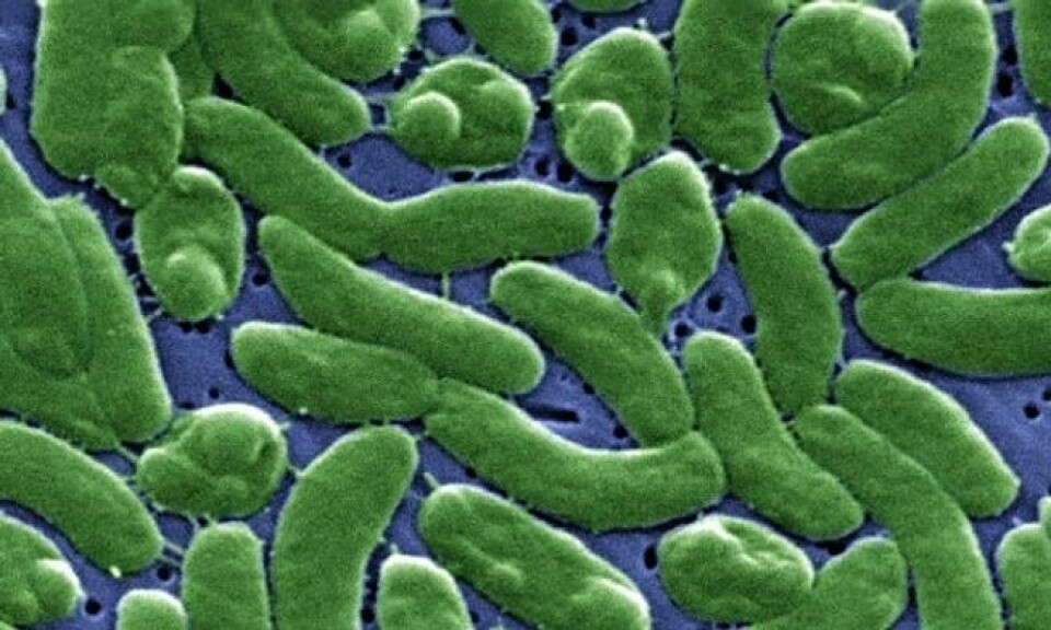 Så og farlige - slik ser Vibrio vulnificus ut under en mikroskop-linse. Foto: CDC/James Gathany Så og farlige - slik ser Vibrio vulnificus ut under en mikroskop-linse. Foto: CDC/James Gathany