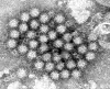 Elektronmikroskopbilde som viser en tett klynge av runde norovirus-partikler.