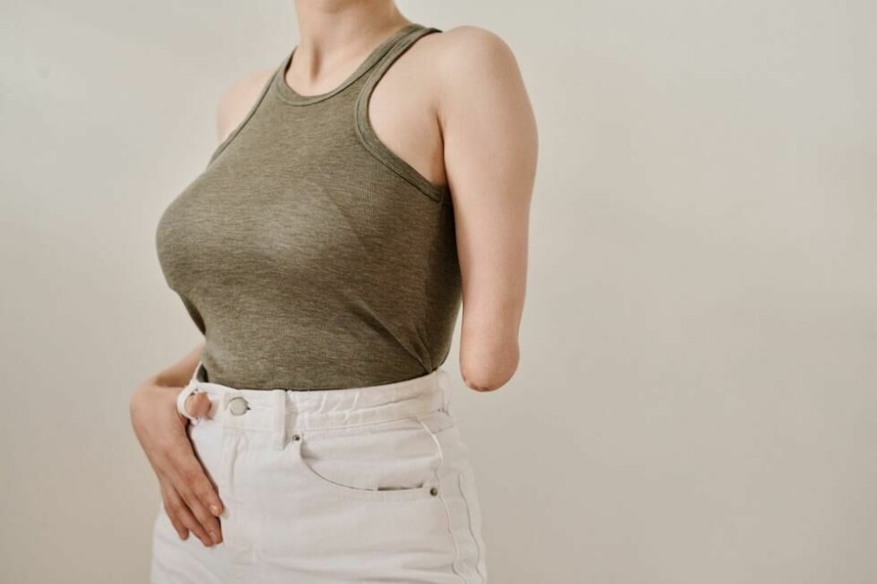 Apotemnofili er seksuell opphisselse forårsaket av fantasien om å være sammen med en amputert. Noen kan også ville ønske å amputere et bein eller en arm. Apotemnofili er seksuell opphisselse forårsaket av fantasien om å være sammen med en amputert. Noen kan også ville ønske å amputere et bein eller en arm. Foto: AnnaStills / Shutterstock / NTB
