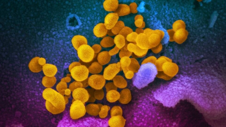 – Vi fant ut at cellene ble sinte og aktiverte det samme som Parkinsons og Alzheimers proteiner kan aktivere. Effekten av en covid-infeksjon ble forverret hvis det allerede var proteiner i hjernen som er assosiert med Parkinsons. Det er som å sette bensin på en brann som allerede starter i hjernen. Det er det som gjør det så farlig, sier professor Trent Woodruff ved avdeling for biomedisin ved University of Queensland i Australia.(NIAID-RML via AP, File)