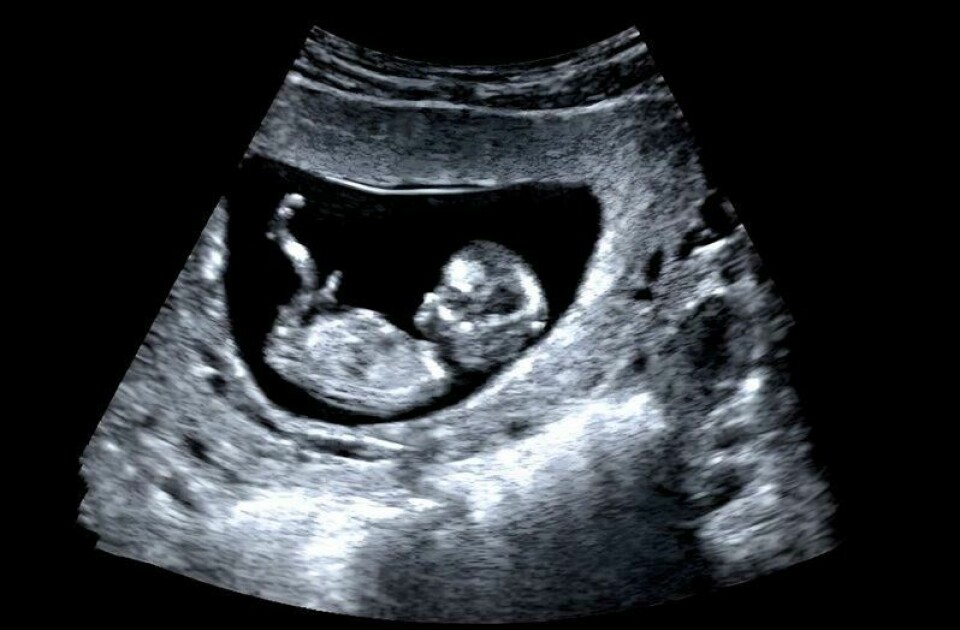 En 15-årig jente ble gravid takket være oralsex og knivstikk.