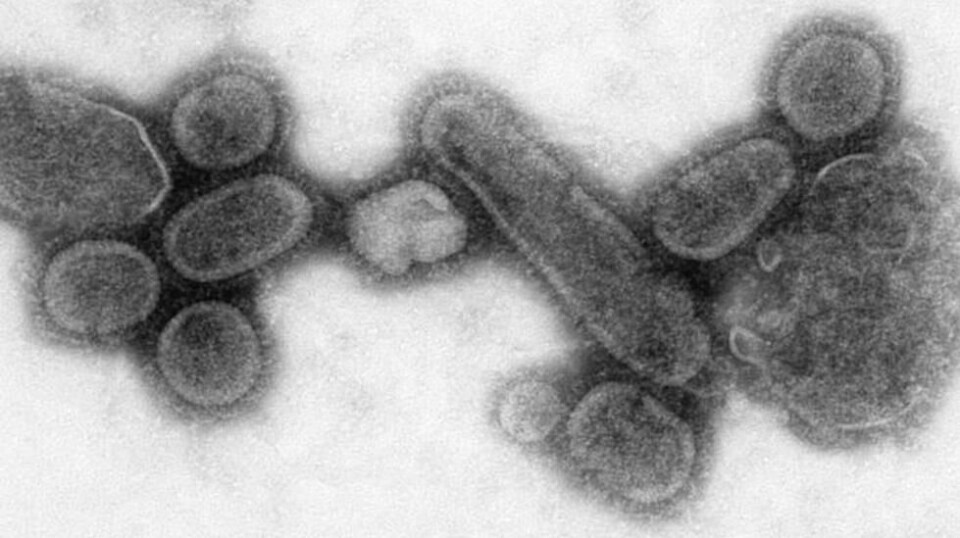 Dette bildet fra US Centers dor Disease Control and Prevention viser H1N1-viruset som forårsaket spanskesyken i 1918.