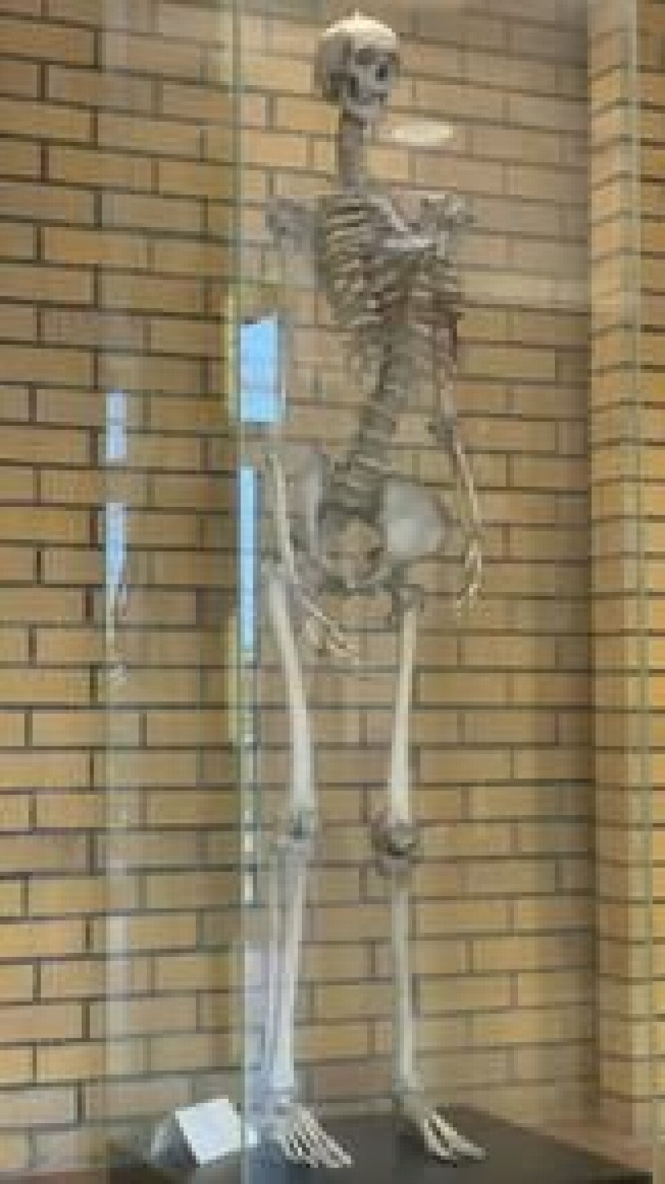 Med sine 213 centimeter, raget Jonas over alle andre. I dag er skjelletet hans utstilt i en glassmonter på rettsmedisinsk institutt i den tyske byen Potsdam. Foto: Sverre Bjørstad Graff Med sine 213 centimeter, raget Jonas over alle andre. I dag er skjelletet hans utstilt i en glassmonter på rettsmedisinsk institutt i den tyske byen Potsdam. Foto: Sverre Bjørstad Graff