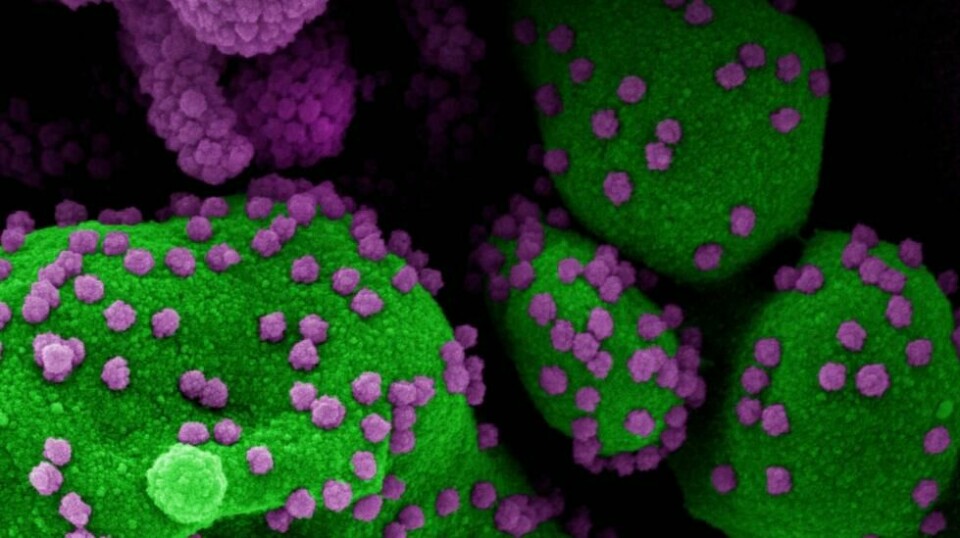 Dette bildet fra National Institute of Allergy and Infectious Diseases (NIH/NIAID) viser en farget skanningelektronmikrograf av en apoptotisk celle (grønn) som er sterkt infisert med Novel Coronavirus SARS-CoV-2 virus partikler (lilla), isolert fra en pasientprøve, ved NIAID Integrated Research Facility (IRF) i Fort Detrick, Maryland.