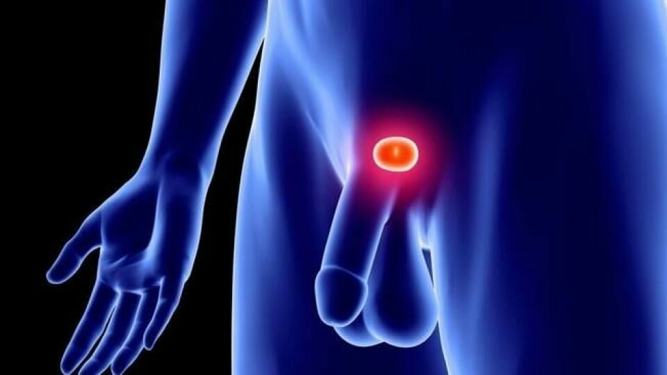 Prostatakjertelen er en valnøttformet kjertel som ligger under blæren, foran endetarmen og omkranser urinrøret. Foto: NTB Scanpix / Science Photo Library Prostatakjertelen er en valnøttformet kjertel som ligger under blæren, foran endetarmen og omkranser urinrøret. Foto: NTB Scanpix / Science Photo Library