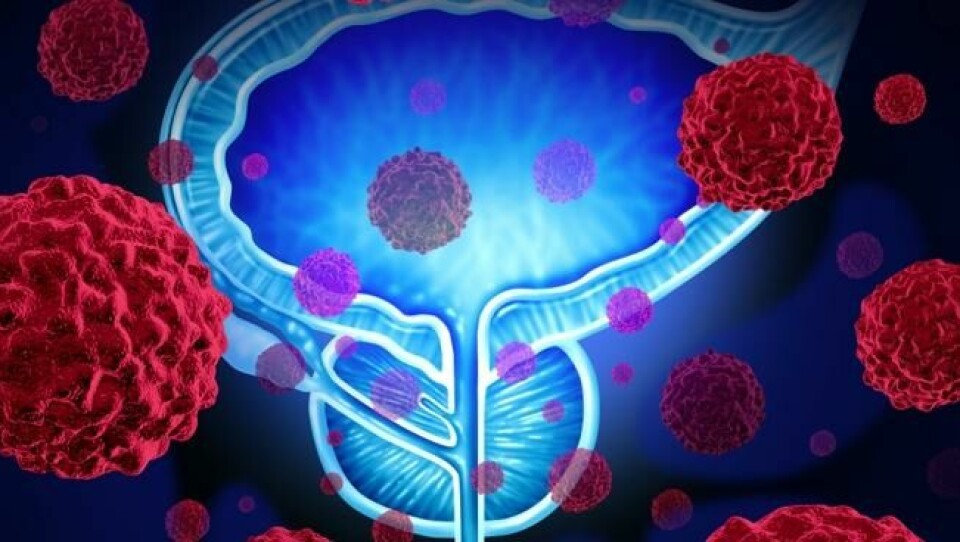Kreft i prostata rammer først og fremst eldre menn og har økt i takt med antallet eldre i befolkningen. Men også stadig flere yngre menn får prostatakreft. Illustrasjonsfoto: Shutterstock / NTB Scanpix Kreft i prostata rammer først og fremst eldre menn og har økt i takt med antallet eldre i befolkningen. Men også stadig flere yngre menn får prostatakreft. Illustrasjonsfoto: Shutterstock / NTB Scanpix