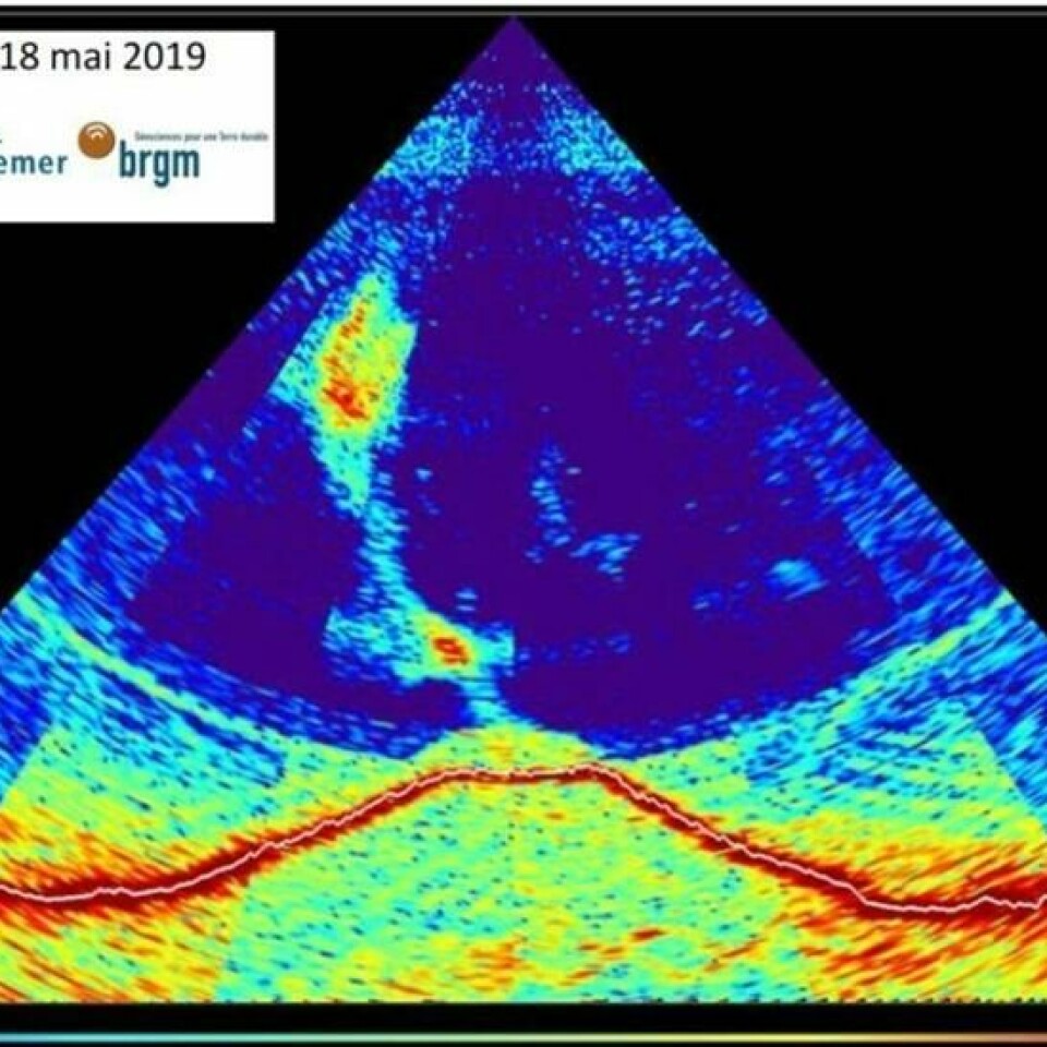 Sonarbildet viser den 800 meter høye nyfødte vulkanen og en to kilometer lang gassøyle som stiger opp fra toppen. Illustrasjon: Twitter/@RLacassin