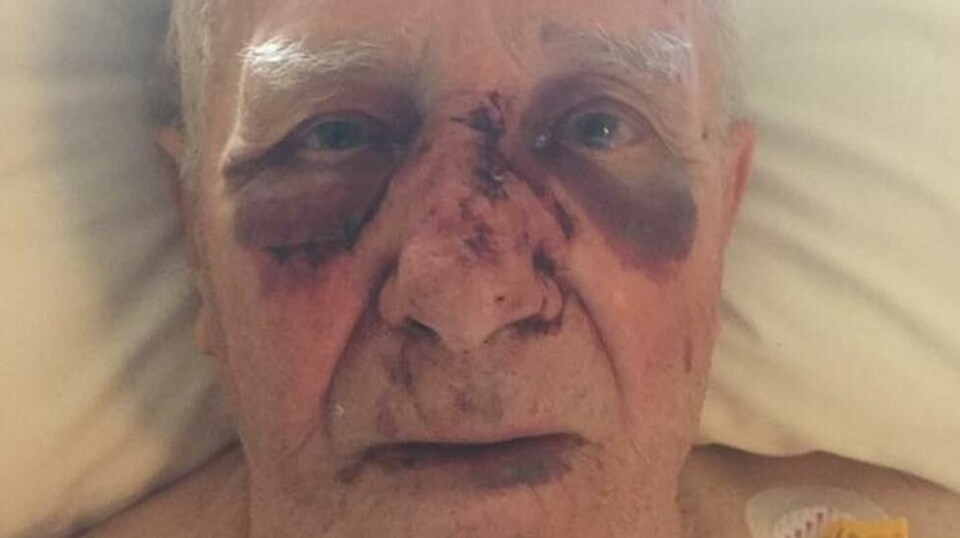 Trygve Styve (90) falt over rullatoren og slo ansiktet rett i bakken. Hans største ønske er å få fast plass på sykehjem, men kommunen sier han er 'for frisk og velfungerende'. Foto: Privat
