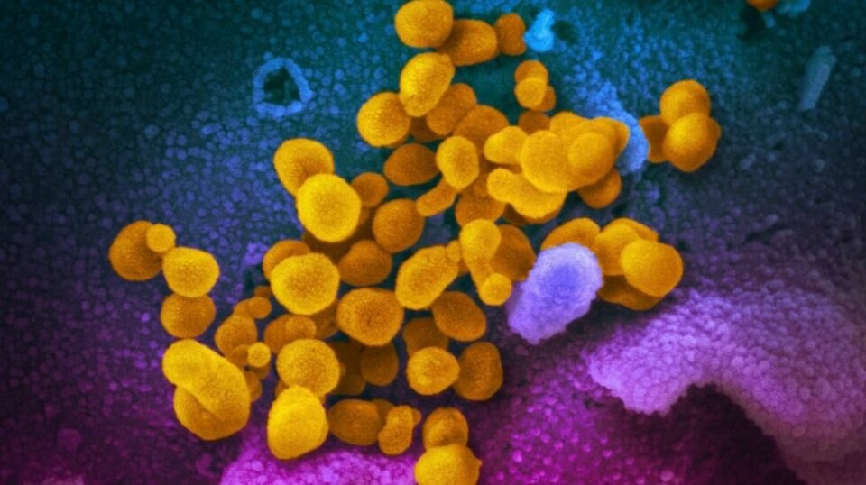 Kinesiske forskere eksperimenterte med GX_P2V, en mutert stamme av et coronavirus som ble funnet hos malaysiske pangoliner i 2017. Illustrasjonsfoto.