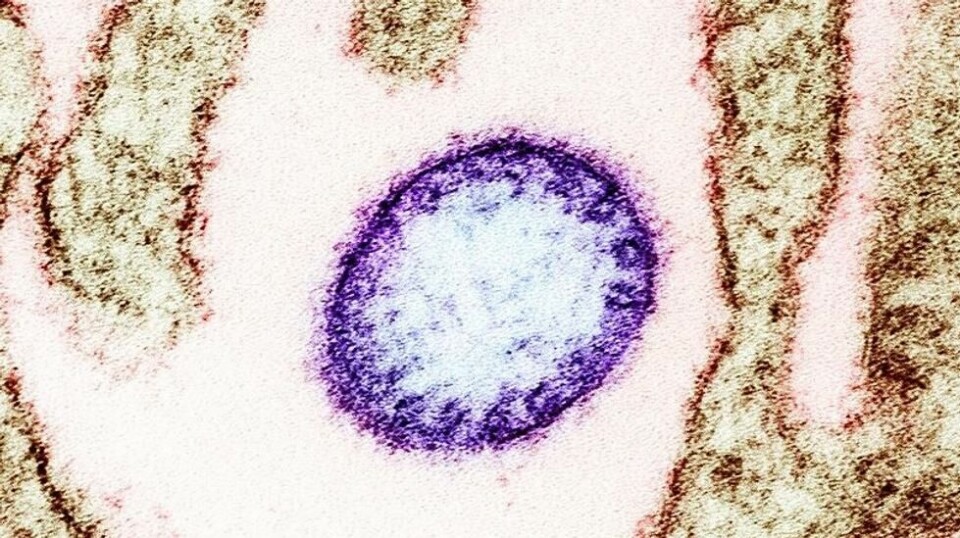 Bildet viser en Verocelle infisert av Nipah-viruset. Den lilla sirkelen viser viruset.