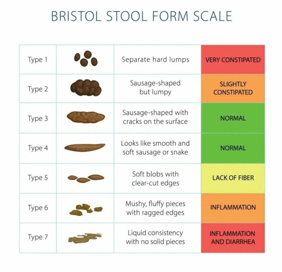 Ser avføringen din ut som den skal? Hvis du er i tvil, kan du rådføre deg med Bristol Stool Form Scale. Illustrasjonsbilde. Ser avføringen din ut som den skal? Hvis du er i tvil, kan du rådføre deg med Bristol Stool Form Scale. Illustrasjonsbilde. Foto: Shutterstock/NTB