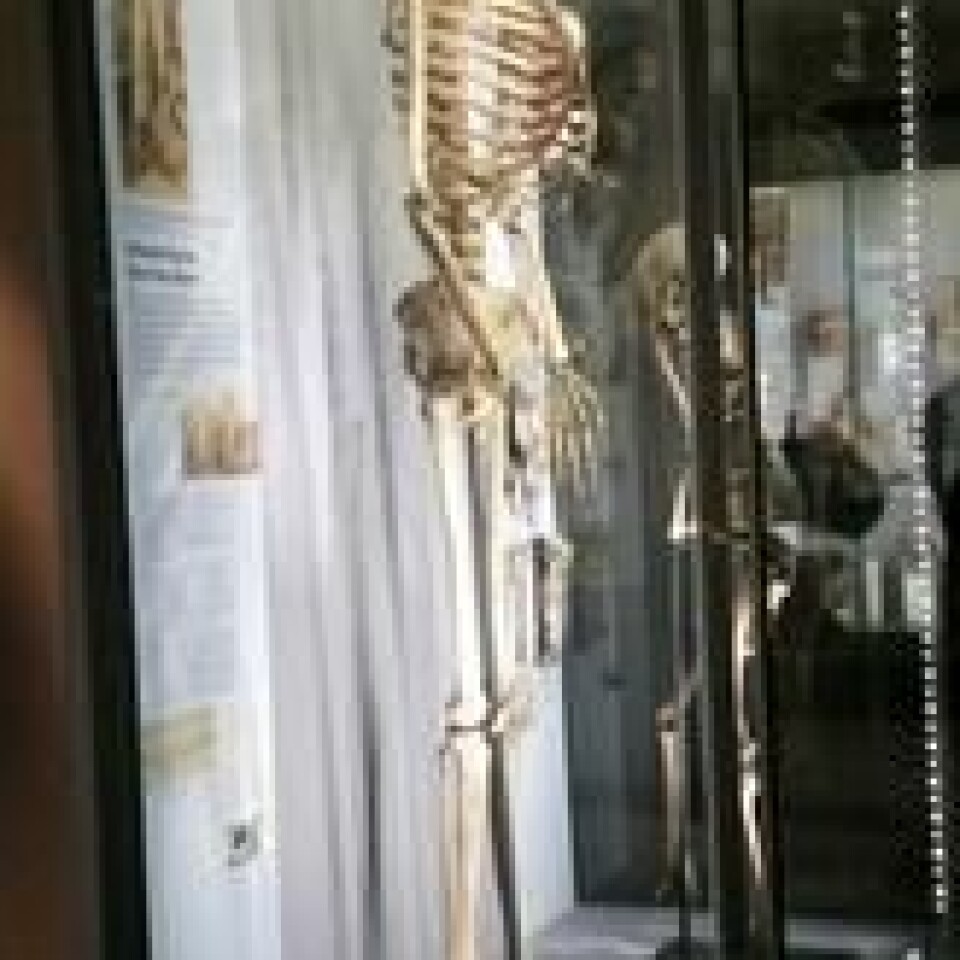 Skjelettet til Charles Byrne har vært utstilt på Hunterian Museum i nesten 240 år. Det var hans verste frykt. Skjelettet til Charles Byrne har vært utstilt på Hunterian Museum i nesten 240 år. Det var hans verste frykt. Foto: Emőke Dénes/Wiki Media