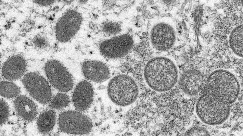 Dette mikroskop-bildet viser forskjellige typer apekopp-virus. Foto: Cynthia S. Goldsmith / Russell Regner / CDC / AP / NTB