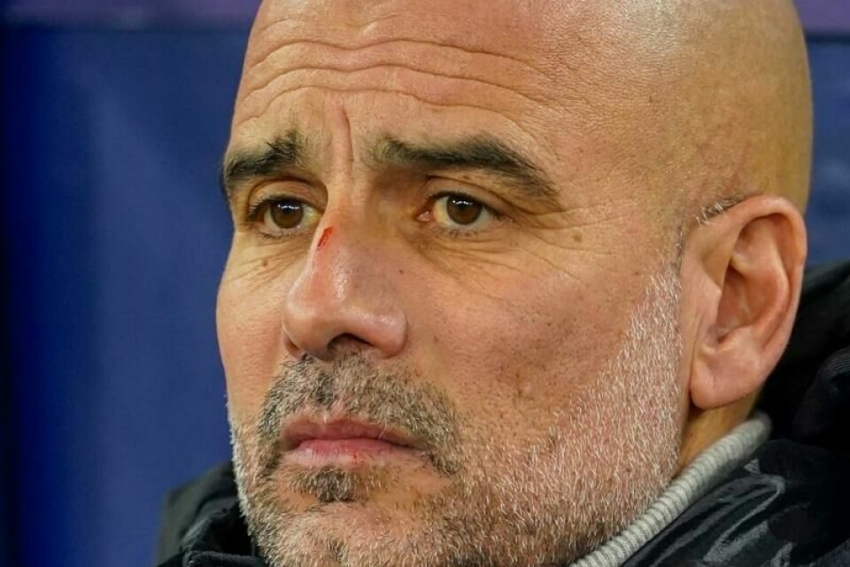 Manchester City-manager Pep Guardiola beklager svaret han ga om skadene han har i ansiktet etter 3-3-kampen mot Feyenoord.