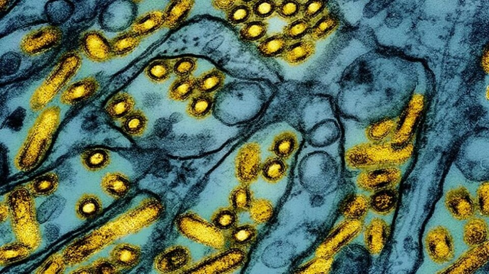 Et fargelagt mikroskop-bilde av H5N1-viruset.