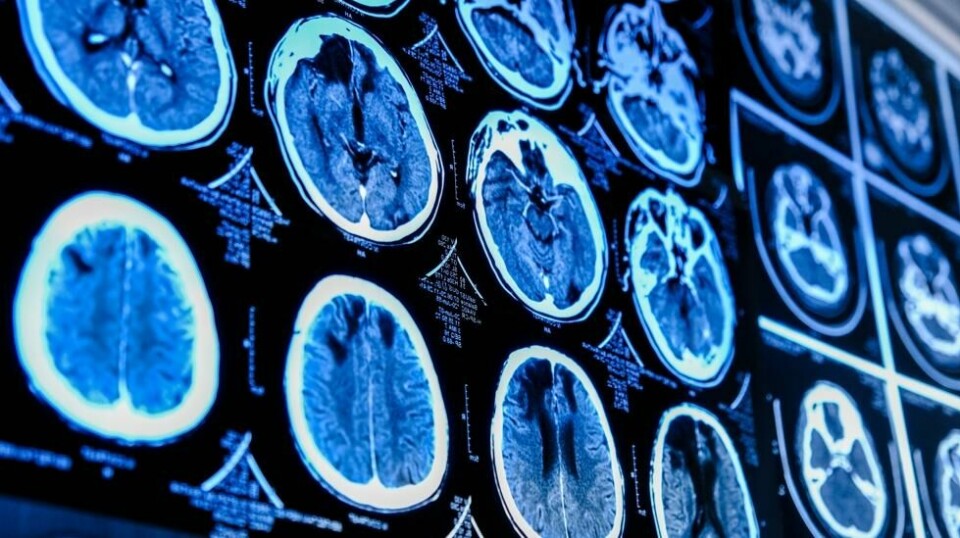 Den nye teknologien bruker kunstig intelligens for å markere områder med kreft.