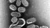 Influensavirus under mikroskop. Dette viruset er sannsynligvis det som herjet under spanskesyken i 1918. (Foto: CDC)