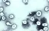 Humant coronavirus OC43 (HCoV-OC43) som kan infisere mennesker og kveg og blant coronavirusene som står for 10-15 prosent av alle forkjølelsestilfellene. Foto: CDC / Public Domain