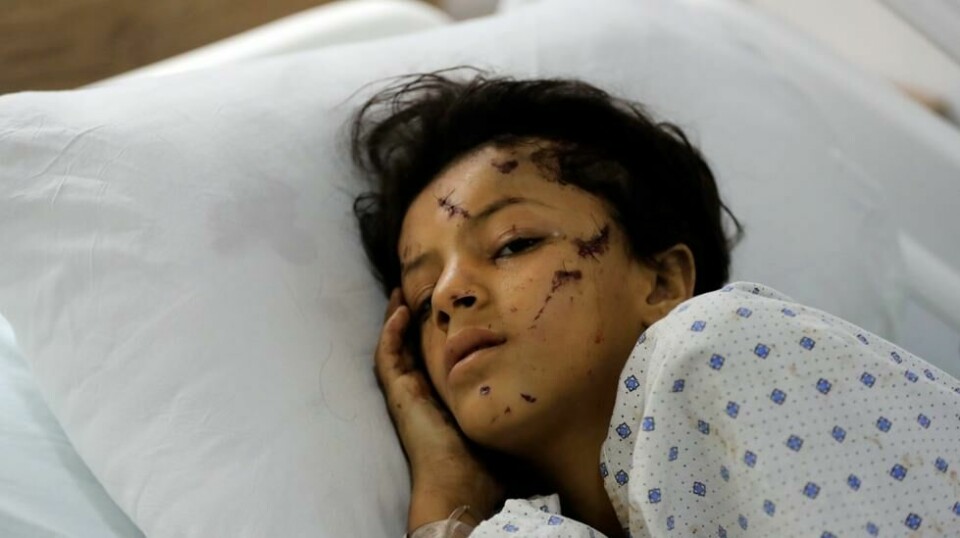 35 barn var ifølge libanesiske helsemyndigheter blant de 492 som ble drept i israelske angrep mandag. Det er også mange barn blant de over 1600 sårede, blant dem denne jenta som ligger på et sykehus i Saksakieh i Sør-Libanon. Foto: AP / NTB
