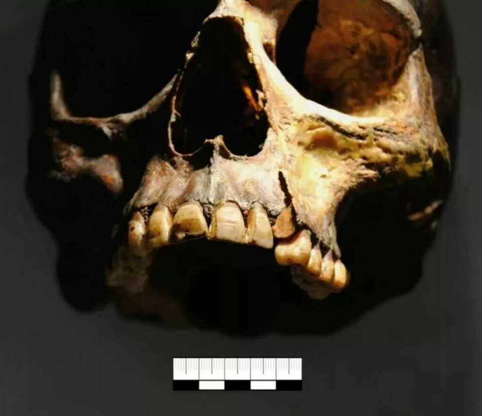 Selv om de fleste av levningene er fra Gotland, trekker studien også veksler på tannsett fra andre steder, som denne russiske vikingskallen med lignende riller. Selv om de fleste av levningene er fra Gotland, trekker studien også veksler på tannsett fra andre steder, som denne russiske vikingskallen med lignende riller. Foto: Valerie Elena Palmowski