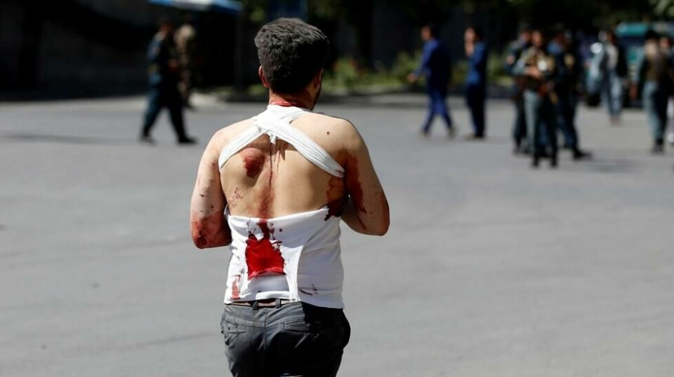 En skadet mann vandrer i Kabul etter angrepet onsdag.