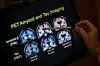 PET-scan som ledd i en Alzheimers-studie ved Georgetown-universitetet i Washington i USA. Arkivfoto: NTB Scanpix/AP.