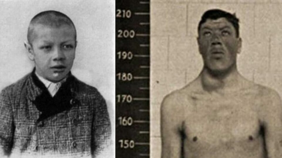 Østerrikeren Adam Rainer (1899-1950) er det eneste kjente menneske i historien som har gått fra dverg til kjempe. Foto: Ukjent.